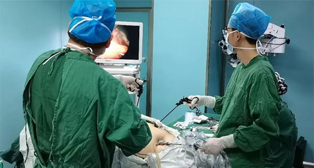 合肥中山医院外科 腹腔镜下袖状胃切除术