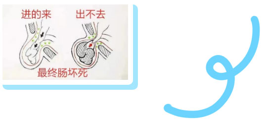 勿以“疝”小而不为：正确认识腹股沟疝