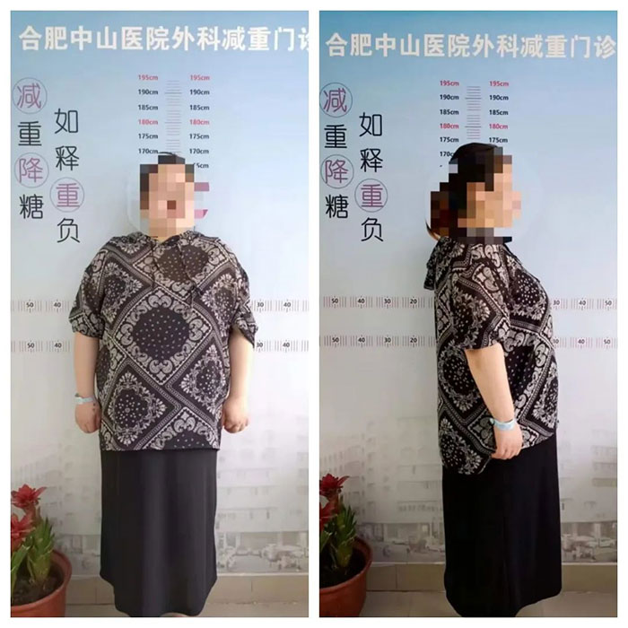 你的“难瘦”，我来“解围”!
