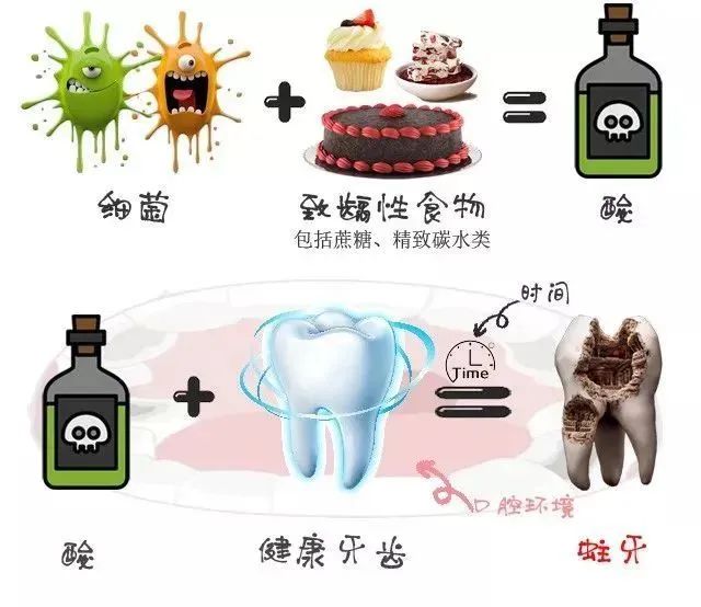 【暖民心行动之健康口腔行动】儿童口腔健康的头号杀手——龋齿