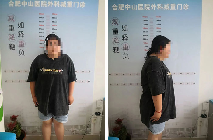 15岁女孩体重达210多斤，减肥之路我们一同陪伴……