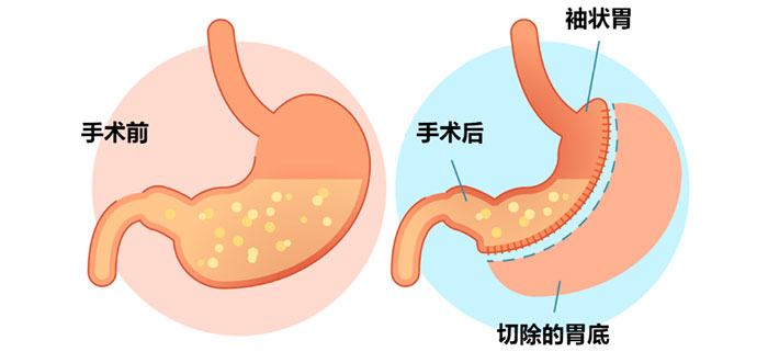 【专家指导 科学减重】我院开展减重知识培训活动