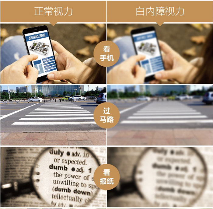 关于白内障，这些知识帮父母了解!